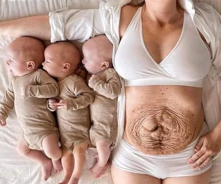 Mother giving birth to triplets