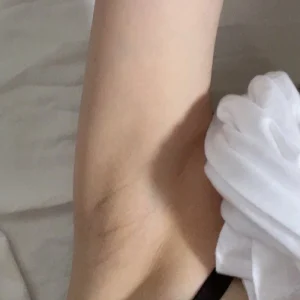 armpit