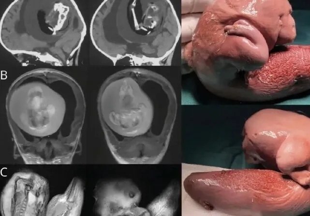 [Disgust] It is said to be a """"fetus"""" extracted from the brain of a one-year-old baby.